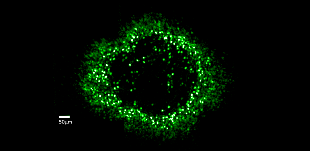 Green ring of cells