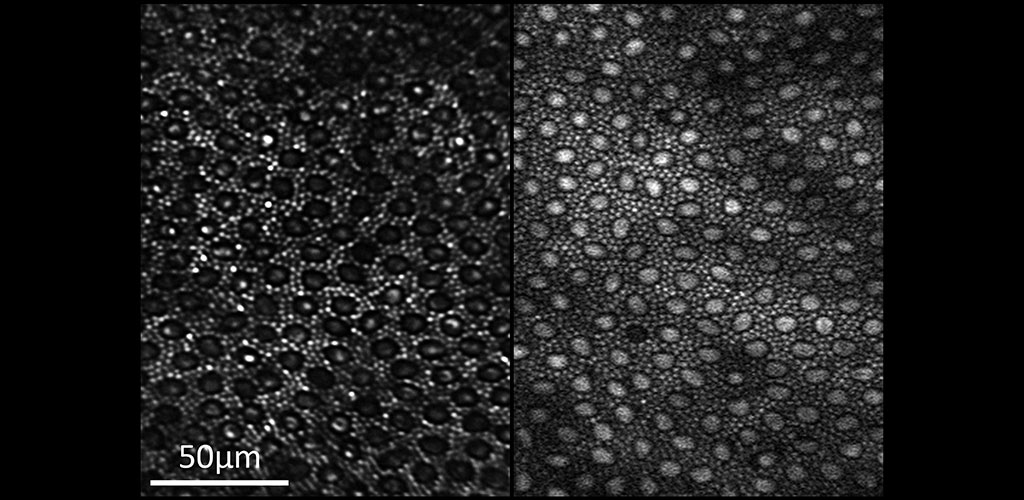 Two-photon fluorescence image of living primate retina