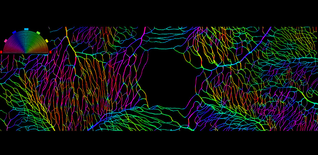 Color photo of capillaries of the retina