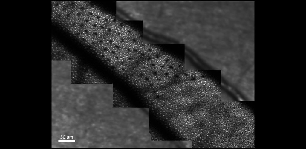 two-photon excited fluorescence