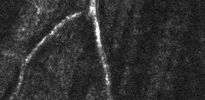 through-focus video of the 3 retinal vascular layers, imaged with adaptive optics