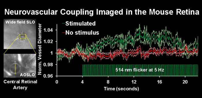 Confocal AOSLO reveals the bore of the central retinal artery en face using NIR, 796nm light