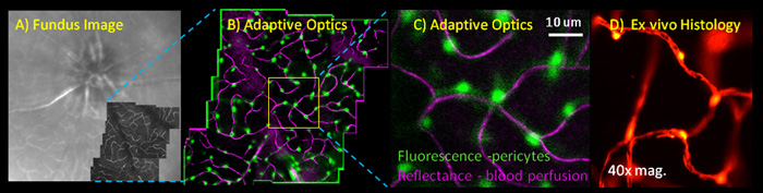 extrinsically labeled pericytes for the Neural-glial antigen 2