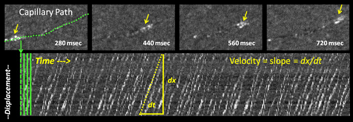 Blood cells in a single capillary path imaged without contrast agents