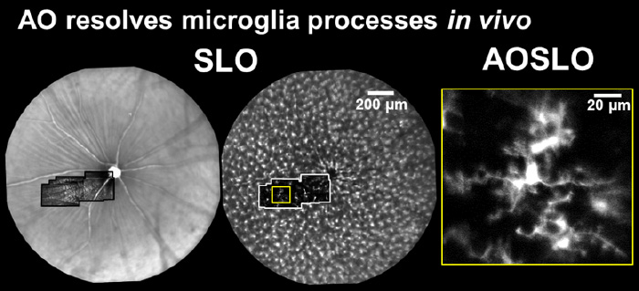 AO resolves microglia processes in vivo