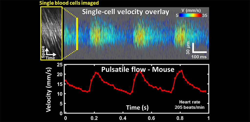 Blood cell velocity color coded