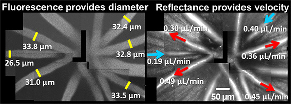 total blood flow in mouse retina